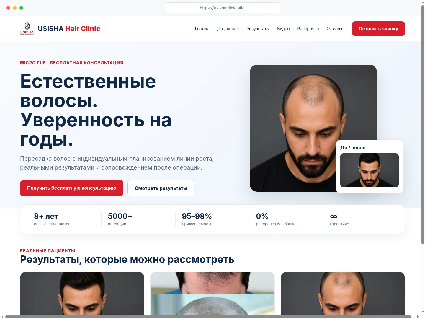 USISHA Hair Clinic live website